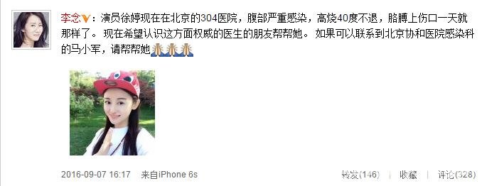 徐婷因恶性淋巴癌肿瘤引起肺部严重感染
